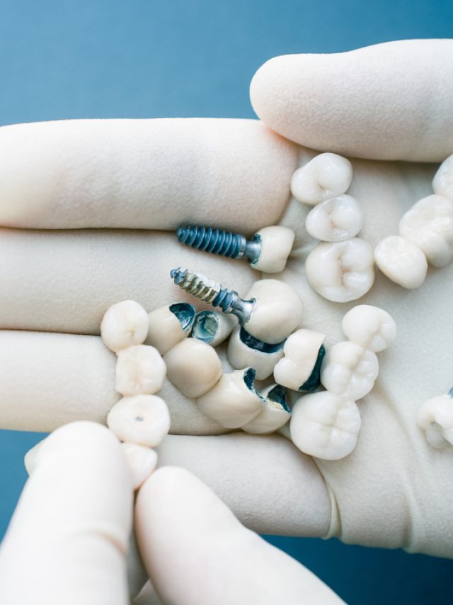 When would implants become a complex procedure?